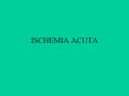 ischemia acuta