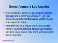 Porcelain Dental Veneers – How They Can Give You a Brand New Smile