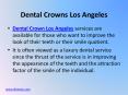 Dental Crowns Los Angeles