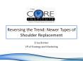 Reversing the Trend: Newer Types of Shoulder Replacement