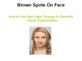 Brown Spots on Face - How to Use Red Light Therapy to Diminish Hyper Pigmentation