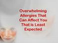 Overwhelming Allergies That Can Affect You That is Least Expected