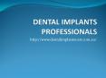 Lowest Dental Implants Cost
