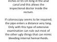 4 simple home remedies for hemorrhoids in children