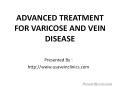 Advanced Treatment for varicose and vein disease