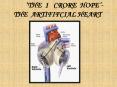 artificial heart- a new life