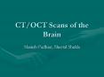 CT/OCT Scans of the Brain Manish Padhiar, Sheetal Shukl