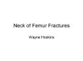 Neck of Femur Fractures Wayne Hoskins Background NOF # 