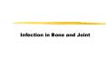 Infection in Bone and Joint Infection in bone Osteomyeliti