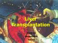 Liver Transplantation for Alcoholic Liver Disease Live