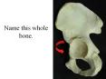 Name this whole bone. Os coxa Name this depression