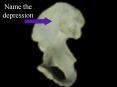 Name the depression Iliac fossa Name the spine Anterio