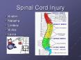 Spinal Cord Injury Kirsten Natasha Lindsey Vickie Laur