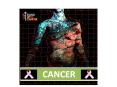 CANCER CONTENT What is cancer? Origin of cancer Commo