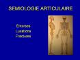 SEMIOLOGIE ARTICULAIRE Entorses Luxations Fractures ENTORS