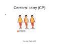 Cerebral palsy (CP) CP W & W 1966-1975 Non-specific ter