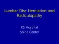 Lumbar Disc Herniation and Radiculopathy KS Hospital Spin
