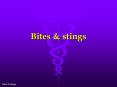 Dog Bites and Rabies (2 of 2) Rabies- an acute vira