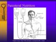 Parenteral Nutrition Graphic sourc