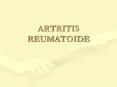 ARTRITIS REUMATOIDE Tratamiento de la Artritis Reumatoid