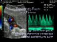 Ecotomografia Doppler en el Embarazo Dr. Daniel Rodriguez A