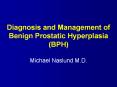Diagnosis and Management of Benign Prostatic Hyperplasi