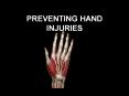 PREVENTING HAND INJURIES How important are your hands? Th