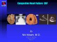 Congestive Heart Failure CHF SUGAR LAND HEART CENTER By Ni