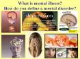 What is mental illness? How do you define a mental disorder
