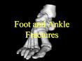Foot and Ankle Fractures Foot and Ankle Fractures Anatom
