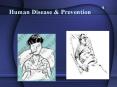 Human Disease & Prevention What is Disease? A disease i