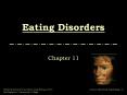 Eating Disorders Chapter 11 Eating Disorders Although no