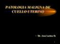 patologia maligna de cuello uterino dr. jos  lattus o