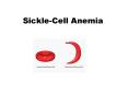 Sickle-Cell Anemia Symptoms Anemia: The shriveled bloo