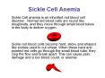 Sickle Cell Anemia Sickle Cell anemia is an inherited re