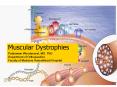 Muscular Dystrophies Patarawan Woratanarat, MD, Ph