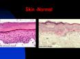 Skin -Normal Skin -Normal Stratified Squamous epithelia