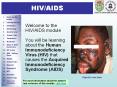 Introduction 1 HIV/AIDS Welcome to the HIV/AIDS module Yo