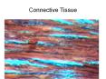 Connective Tissue Dense fibrous regular connective tissue