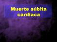 Muerte s bita cardiaca * * * * * * * * * * * * * CLASE II
