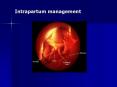 Intrapartum management Labor Labor is defined b