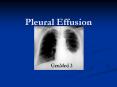 Pleural Effusion GenMed 3 Development of Pleural Effusio
