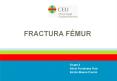 FRACTURA F MUR Grupo 3 Alicia Fern ndez Ruiz Emilio Blasc
