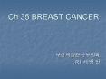 Ch 35 BREAST CANCER            R1       1/3 of all cancer