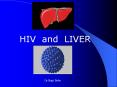 hiv and liver dr.bujji babu liver is the commonest site o