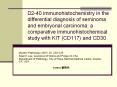 D2-40 immunohistochemistry in the differential diagnosis o