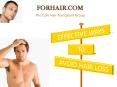 New Hair Transplant Techniques by Forhair Clinic