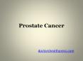 Causes Prevention and Treatments of Prostate Cancer
