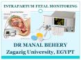 Intrapartum fetal monitoring for undergraduate