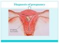 Diagnosis of pregnancy &antenatal care FOR UNDERGRADUATE.